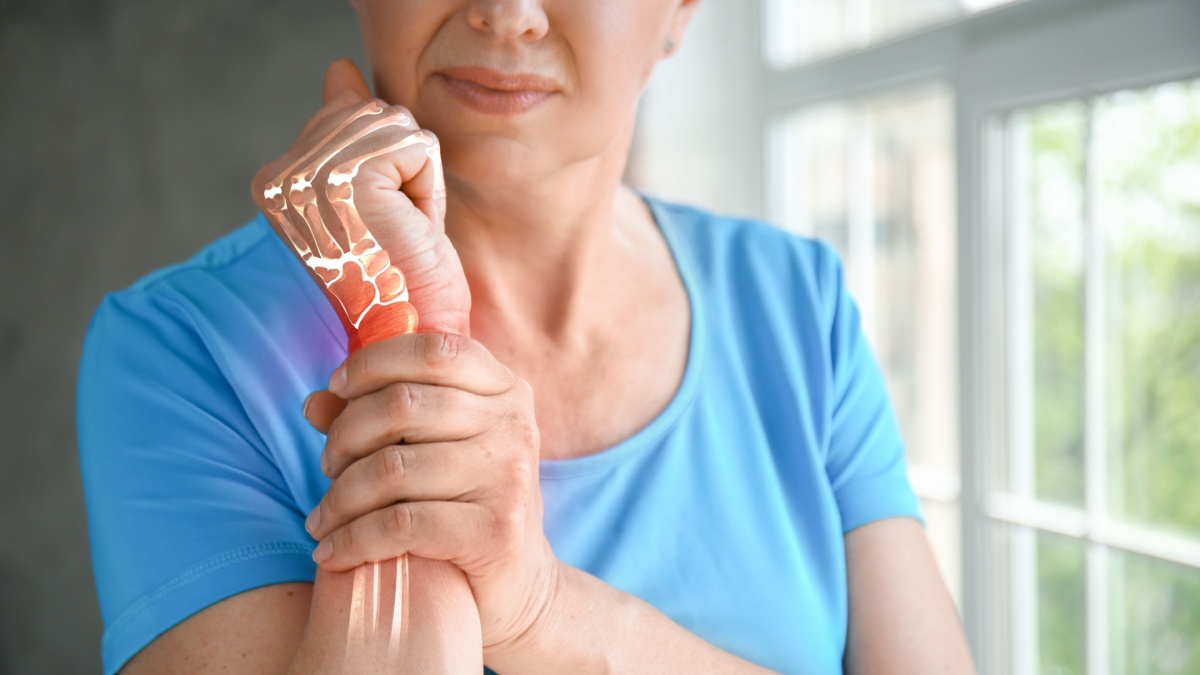 Factori de risc suplimentari ai osteoporozei la pacientii cu lupus