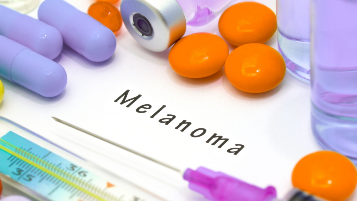 Stadializarea tumorii si rata de supravietuire in cazurile de melanom