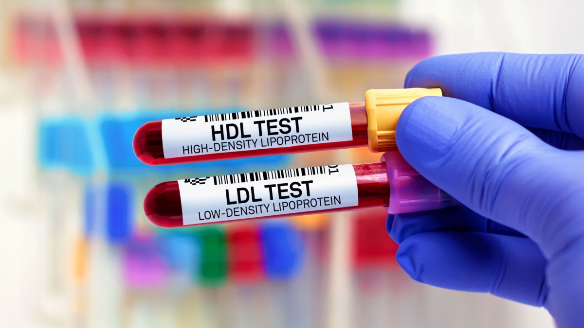 Tipurile de colesterol si lipoproteine: ce trebuie sa stii
