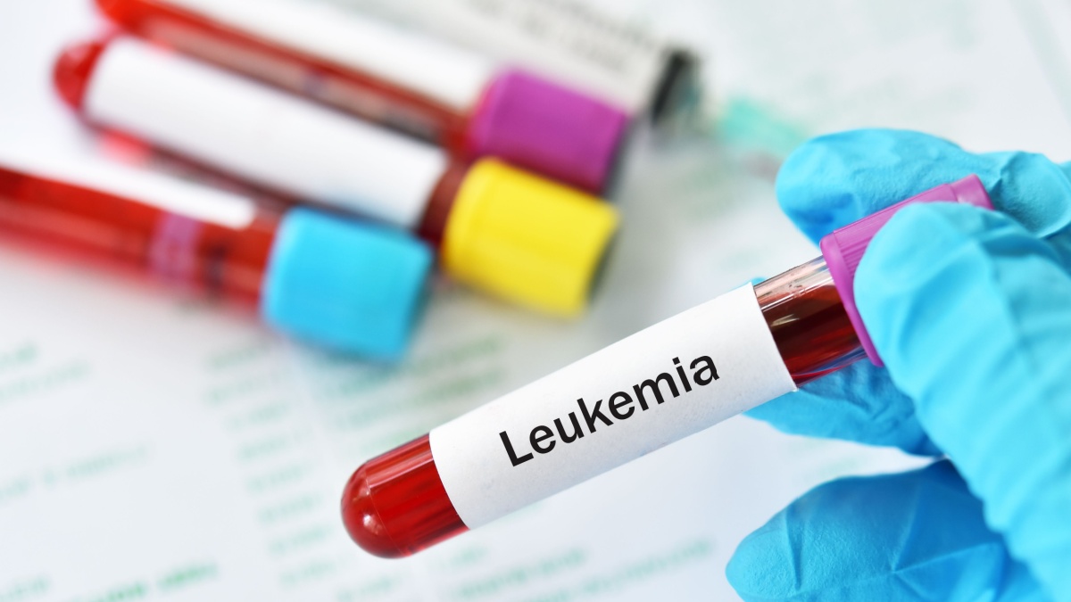 Leucemia acuta versus leucemia cronica: diferente de diagnostic, tratament si prognostic