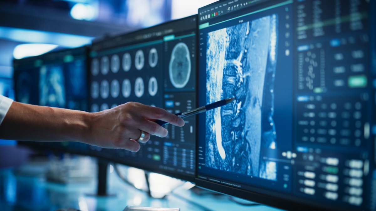 Ecografie, radiografie, CT și RMN: ce sunt și când se recomandă?