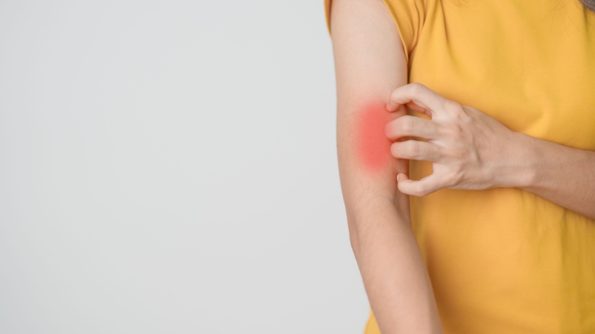 Lupus: cum poți evita puseurile (episoadele de activitate a bolii)?