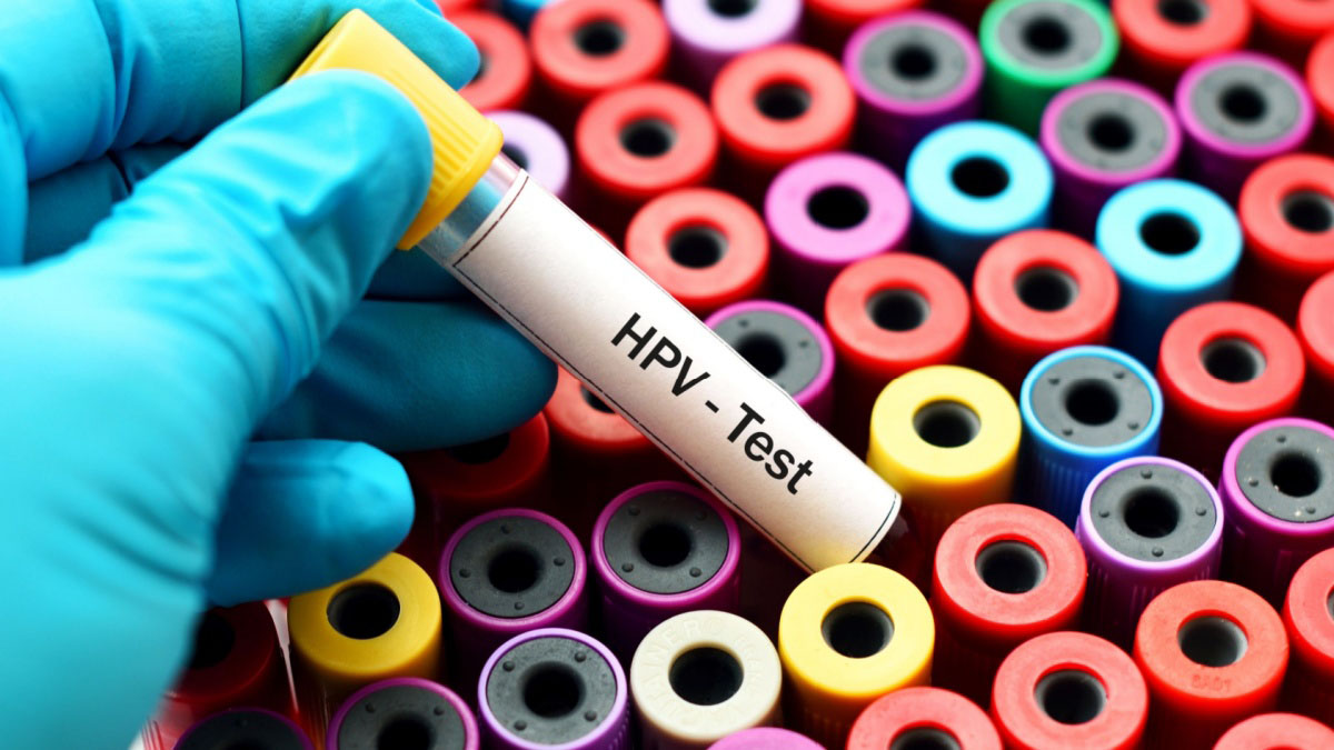 Tot ce trebuie sa stii despre HPV: Simptome & Tratament