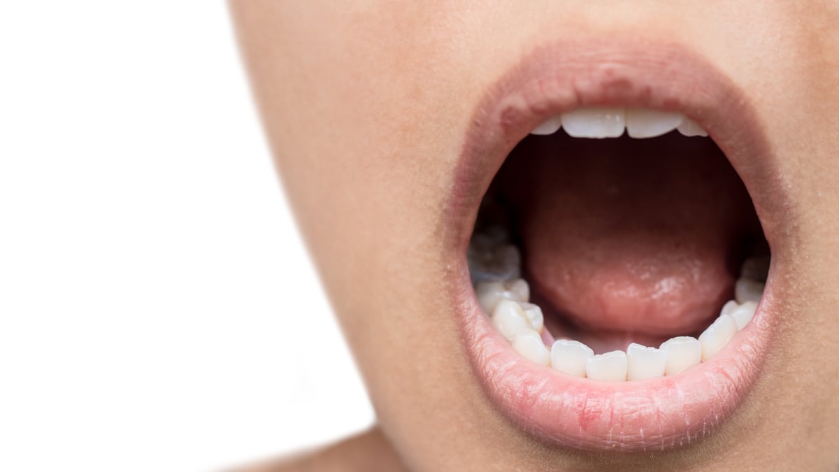 Cum se trateaza uvula umflata (omuletul marit)?