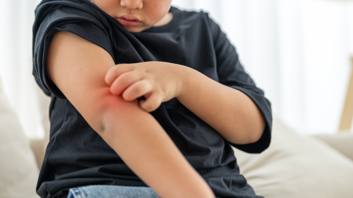 Tot ce trebuie să știi despre artrita psoriazică la copii